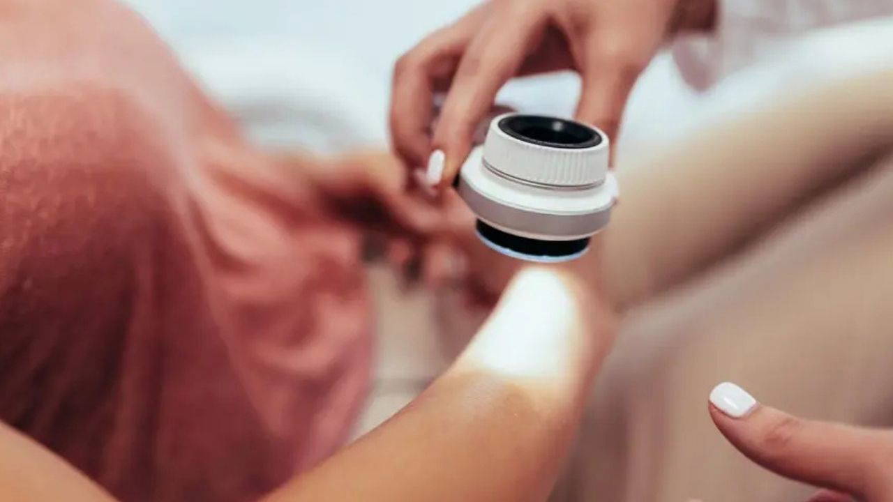 Ameliyatsız Cilt Kanseri Tedavisinde Yenilik: ‘Akıllı Bant’ Teknolojisiyle Umut Verici Gelişme**