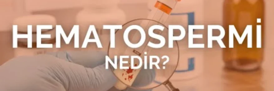 Kanda Sperm Görülmesi: Hematosperm Nedir ve Ne Zaman Tehdit Oluşturur?